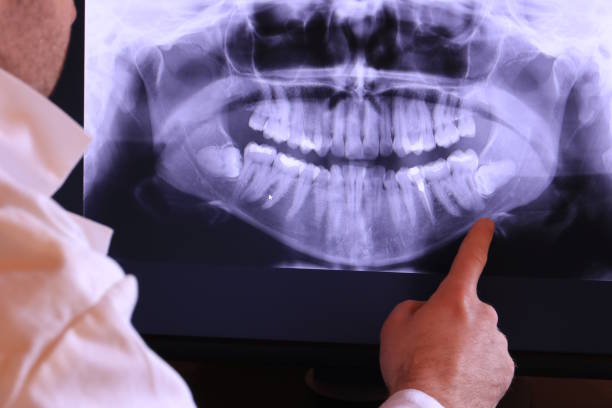 Best Emergency Treatment for Toothache in Lemoore Station, CA