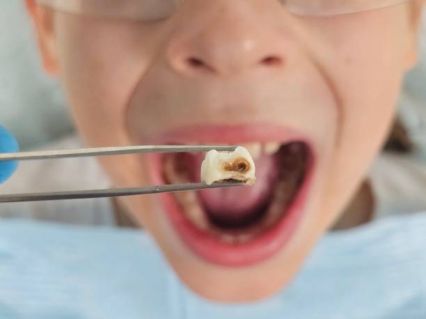 Best Emergency Treatment for Toothache in Lemoore Station, CA